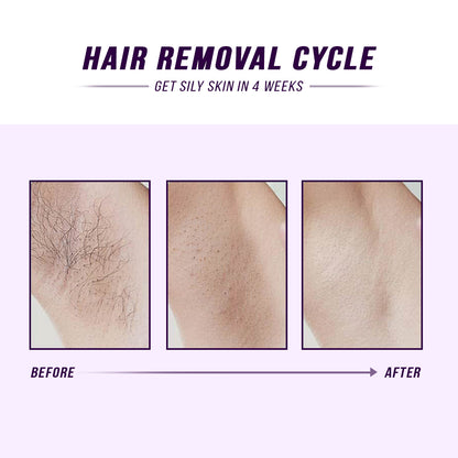 Laser Hair Removal